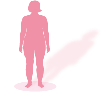 肥満タイプ体型